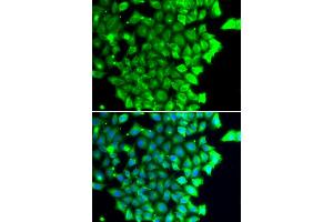 Immunofluorescence analysis of MCF-7 cells using TRIAP1 antibody (ABIN4905489). (TRIAP1 抗体)
