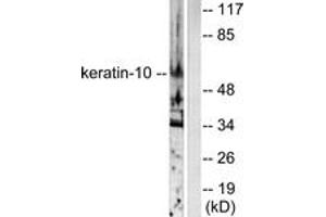 Western blot analysis of extracts from HeLa cells, using Keratin 10 Antibody. (Keratin 10 抗体  (AA 136-185))