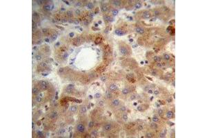 PTEN antibody immunohistochemistry analysis in formalin fixed and paraffin embedded human liver tissue. (PTEN 抗体  (AA 306-335))