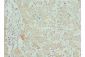 Immunohistochemistry of paraffin-embedded human liver tissue using ABIN7146778 at dilution of 1:100 (CPN1 抗体  (AA 209-458))