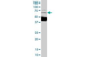 DCP1A monoclonal antibody (M01), clone 2D12. (DCP1A 抗体  (AA 186-285))