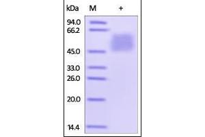 SDS-PAGE (SDS) image for V-Set Domain Containing T Cell Activation Inhibitor 1 (VTCN1) (AA 29-258) (Active) protein (His tag) (ABIN2180624)
