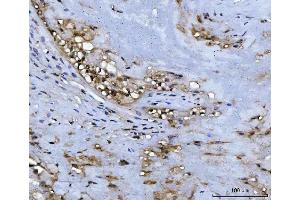IHC analysis of ADK using anti-ADK antibody (ABIN4886430). (ADK 抗体  (AA 165-351))