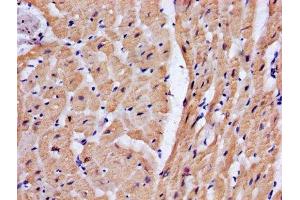 IHC image of ABIN7173586 diluted at 1:200 and staining in paraffin-embedded human heart tissue performed on a Leica BondTM system. (Cardiac Troponin T2 抗体  (AA 138-298))