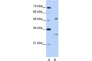 WB Suggested Anti-WBSCR1 Antibody Titration:  2. (EIF4H 抗体  (Middle Region))