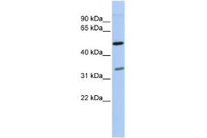 WB Suggested Anti-PQBP1 Antibody Titration:  0. (PQBP1 抗体  (Middle Region))