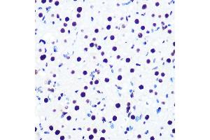 Immunohistochemistry of paraffin-embedded rat ovary using DDX5 Rabbit mAb (ABIN7266698) at dilution of 1:100 (40x lens). (DDX5 抗体)