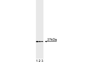 Western Blotting (WB) image for anti-Fas (TNFRSF6)-Associated Via Death Domain (FADD) antibody (ABIN967524) (FADD 抗体)