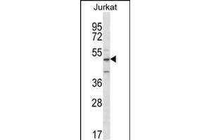 ABI2 Antibody (N-term)  western blot analysis in Jurkat cell line lysates (35 μg/lane). (ABI2 抗体  (N-Term))