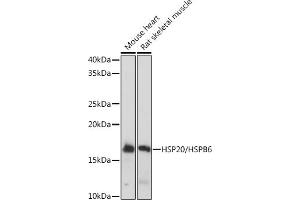 Western blot analysis of extracts of various cell lines, using HSP20/HSPB6 Rabbit mAb (ABIN7267592) at 1:1000 dilution. (HSPB6 抗体)