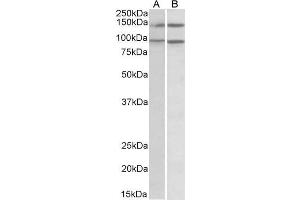 ABIN185123 (0. (ARHGEF18 抗体  (C-Term))