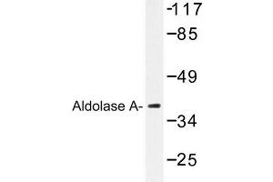 Image no. 1 for anti-Aldolase A, Fructose-Bisphosphate (ALDOA) antibody (ABIN272155) (ALDOA 抗体)