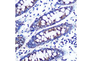 Immunohistochemistry of paraffin-embedded human colon using Monoamine Oxidase B (MAOB) (MAOB) Rabbit mAb (ABIN7268682) at dilution of 1:100 (40x lens). (Monoamine Oxidase B 抗体)