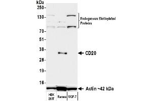 Western Blotting (WB) image for anti-Biotin antibody (ABIN7795748) (Recombinant Biotin 抗体)