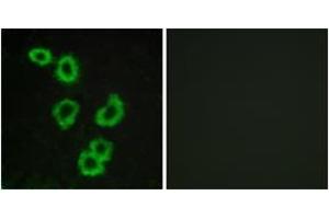 Immunofluorescence analysis of MCF7 cells, using GPR176 Antibody. (GPR176 抗体  (AA 466-515))