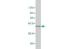 Western Blot detection against Immunogen (36. (Exportin 2 抗体  (AA 872-971))