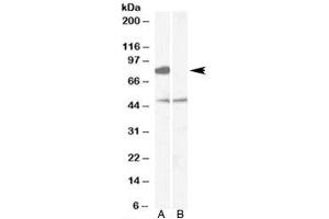 Western blot testing of human brain [frontal cortex] lysate with [B] and without [A] immunizing peptide using ZDHHC8 antibody at 0. (ZDHHC8 抗体)