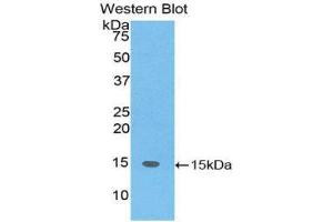 Western Blotting (WB) image for anti-SH2 Domain Containing 1A (SH2D1A) (AA 18-115) antibody (ABIN3202059) (SH2D1A 抗体  (AA 18-115))