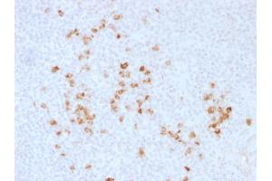 Formalin-fixed, paraffin-embedded human Tonsil stained with Anti-human IgG Rabbit Polyclonal Antibody. (IGHG 抗体)