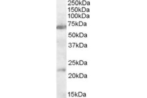 Image no. 1 for anti-Cholinergic Receptor, Nicotinic, alpha 4 (CHRNA4) (AA 29-43), (Internal Region) antibody (ABIN375184) (CHRNA4 抗体  (Internal Region))