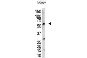 Image no. 1 for anti-RanBP-Type and C3HC4-Type Zinc Finger Containing 1 (RBCK1) (N-Term) antibody (ABIN357475)