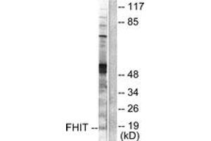 Western blot analysis of extracts from A549 cells, using FHIT Antibody. (FHIT 抗体  (AA 81-130))