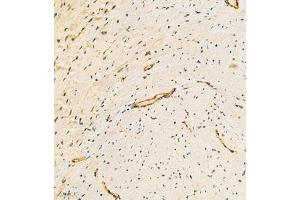 Immunohistochemistry analysis of paraffin embedded mouse heart using ACTN1 (ABIN7072905) at dilution of 1: 300 (ACTN1 抗体)