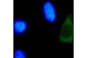 Immunofluorescence (IF) image for anti-Human Papilloma Virus Type 18 (HPV-18) (AA 1-83), (N-Term) antibody (ABIN781773) (HPV18 抗体  (N-Term))