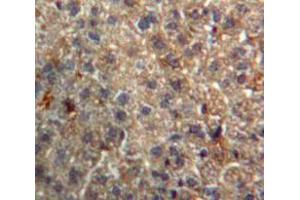 Used in DAB staining on fromalin fixed paraffin-embedded Liver tissue (Importin 8 抗体  (AA 417-622))