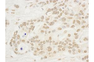 anti-Nucleolar Protein 8 (NOL8) (AA 200-250) antibody