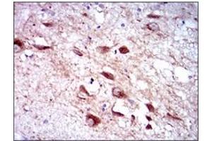 Immunohistochemistry (IHC) image for anti-Cytochrome P450, Family 3, Subfamily A, Polypeptide 4 (CYP3A4) antibody (ABIN1106886)
