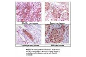 Image no. 1 for anti-RAB25, Member RAS Oncogene Family (RAB25) antibody (ABIN207613) (RAB25 抗体)