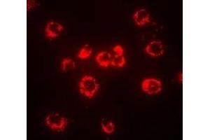 Immunofluorescent analysis of CD288 staining in MCF7 cells. (TLR8 抗体)
