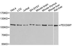 Western blot analysis of extracts of various cell lines, using PDCD6IP antibody. (ALIX 抗体  (AA 1-180))