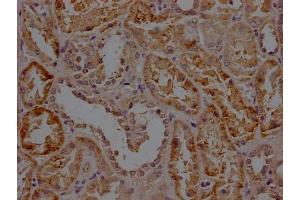 IHC image of ABIN7156171 diluted at 1:200 and staining in paraffin-embedded human kidney tissue performed on a Leica BondTM system. (RHBDF2 抗体  (AA 1-200))