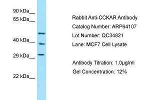 Western Blotting (WB) image for anti-Cholecystokinin A Receptor (CCKAR) (N-Term) antibody (ABIN2789734) (CCKAR 抗体  (N-Term))