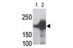LRP5 antibody used in western blot to detect recombinant human LRP5 (Lane 1) and mouse LRP5 (2) proteins in transfected 293 cell lysate (LRP5 抗体  (AA 1538-1567))