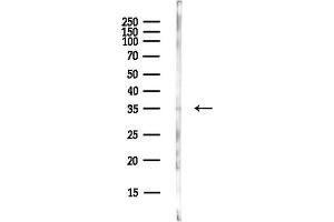 Western blot analysis of lysates from EC304 cells(LPS,4h treatment), using XRCC3 Antibody at 1/1000 dilution.