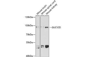 Western blot analysis of extracts of various cell lines, using GUCY2D antibody (ABIN1680144, ABIN3017868, ABIN3017870 and ABIN6220291) at 1:1000 dilution. (GUCY2D 抗体  (AA 52-350))
