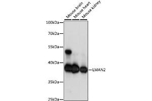 Western blot analysis of extracts of various cell lines, using LM antibody (ABIN7268203) at 1:1000 dilution. (LMAN2 抗体  (AA 190-320))