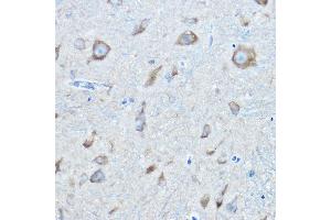 Immunohistochemistry of paraffin-embedded mouse spinal cord using SARS Rabbit pAb (ABIN6127528, ABIN6147383, ABIN6147385 and ABIN6217311) at dilution of 1:100 (40x lens). (Seryl-tRNA Synthetase (SARS) (AA 1-300) 抗体)