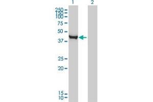 Western Blot analysis of CTH expression in transfected 293T cell line by CTH monoclonal antibody (M03), clone S51. (CTH 抗体  (AA 1-405))