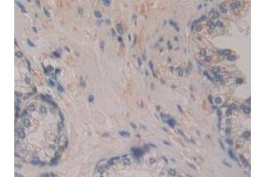 Immunohistochemistry (IHC) image for anti-Breast Carcinoma Amplified Sequence 3 (BCAS3) (AA 230-546) antibody (ABIN7443374)