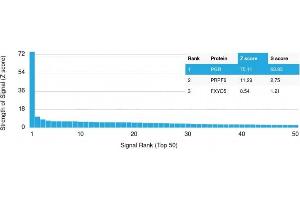 Analysis of Protein Array containing more than 19,000 full-length human proteins using Progesterone Receptor Mouse Monoclonal Antibody (PGR/2694). (Progesterone Receptor 抗体  (AA 483-571))