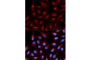 Immunofluorescence analysis of U20S cell using TLE1 antibody. (TLE1 抗体)
