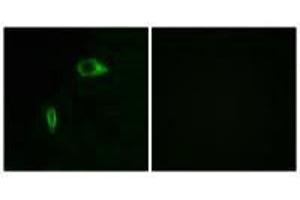 Immunofluorescence analysis of HeLa cells, using Collagen XIV α1 antibody. (COL14A1 抗体)