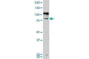 NEK5 monoclonal antibody (M02), clone 7G2. (NEK5 抗体  (AA 601-708))