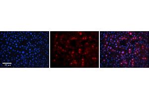 Rabbit Anti-RAD54B Antibody      Formalin Fixed Paraffin Embedded Tissue: Human Adult Liver   Observed Staining: Nuclear in hepatocytes, strong signal, wide tissue distribution  Primary Antibody Concentration: 1:100  Secondary Antibody: Donkey anti-Rabbit-Cy3  Secondary Antibody Concentration: 1:200  Magnification: 20X  Exposure Time: 0. (RAD54B 抗体  (Middle Region))