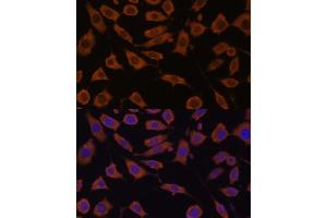 Immunofluorescence analysis of L929 cells using STUB1 Polyclonal Antibody (ABIN6129459, ABIN6148649, ABIN6148650 and ABIN6215447) at dilution of 1:100 (40x lens). (STUB1 抗体  (AA 1-303))