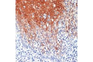 Immunohistochemistry of paraffin-embedded human tonsil using S100 antibody (ABIN7270129) at dilution of 1:200 (40x lens). (S100A8 抗体  (AA 1-93))